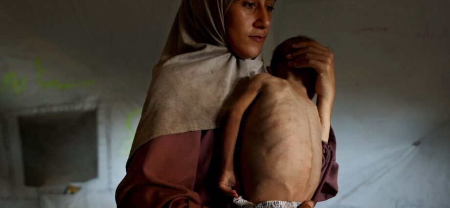 ‘Not eating for days’: Gaza’s worsening starvation crisis | Israel-Palestine conflict News