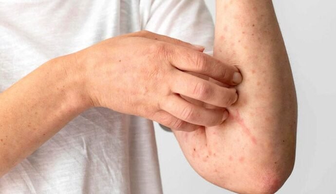 1497780 115620 updates