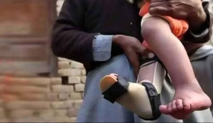 1498081 115424 updates