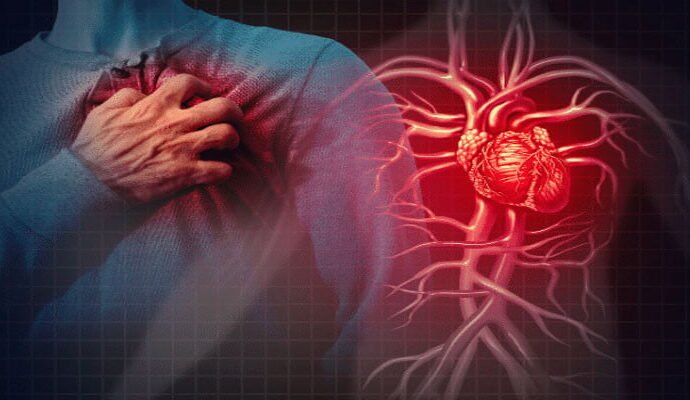 1499701 115247 updates