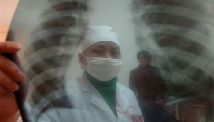 کوویڈ 19 کے مریضوں کے خون کی شریانوں میں قبل از وقت بڑھاپے کی علامات، خواتین زیادہ متاثر 1 1502458 112634 updates