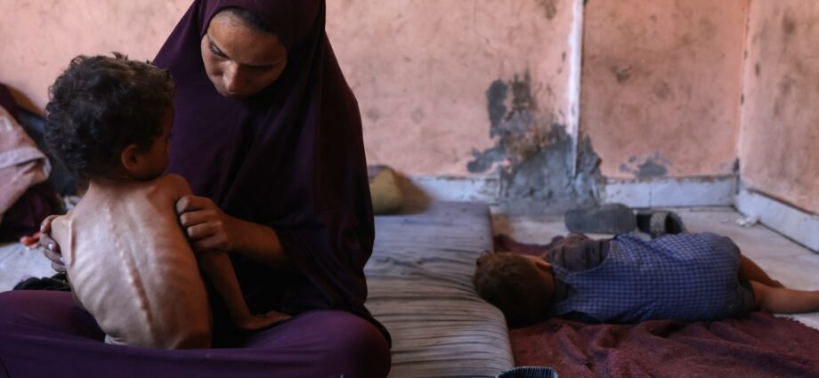 Amid Gaza famine, Palestinian girl struggles to survive | Gaza News 1 Amid Gaza famine, Palestinian girl struggles to survive | Gaza News