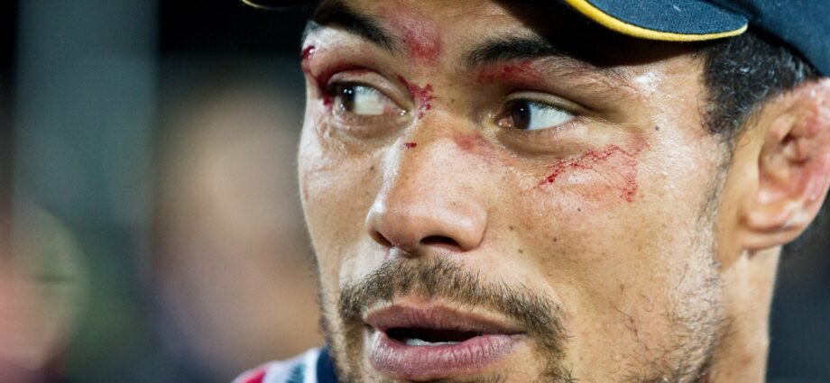 New Zealand rugby player who called for study of concussions dies at 39 | Rugby News 1 New Zealand rugby player who called for study of concussions dies at 39 | Rugby News