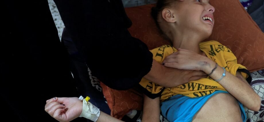 Tens of thousands of Palestinian children starving in Gaza tent camps | Israel-Palestine conflict News 1 Tens of thousands of Palestinian children starving in Gaza tent camps | Israel-Palestine conflict News