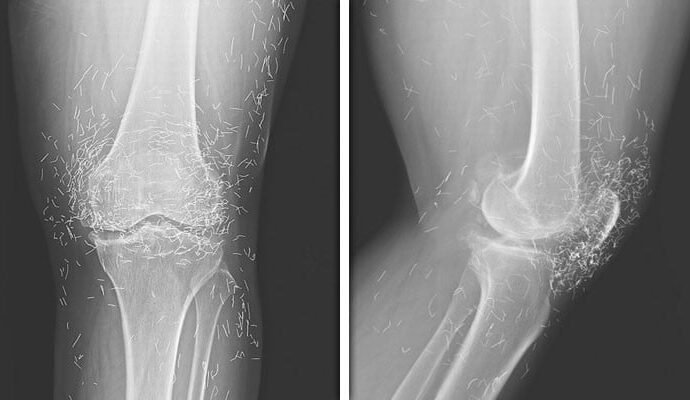 1507401 034310 updates