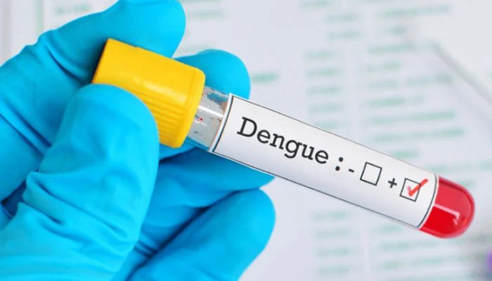 1528950 102041 updates