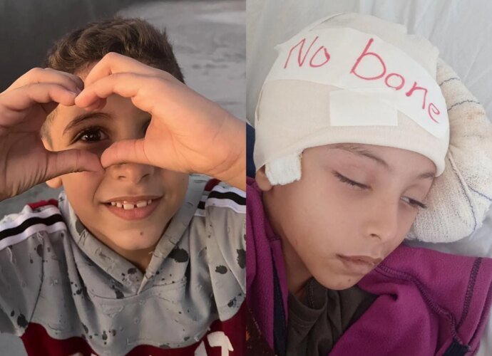 It’s not just Israel to blame for the medical evacuation crisis in Gaza | Israel-Palestine conflict