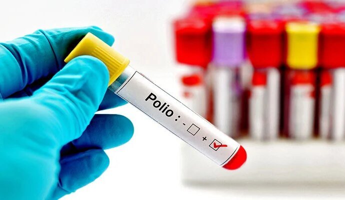 1545485 125116 updates