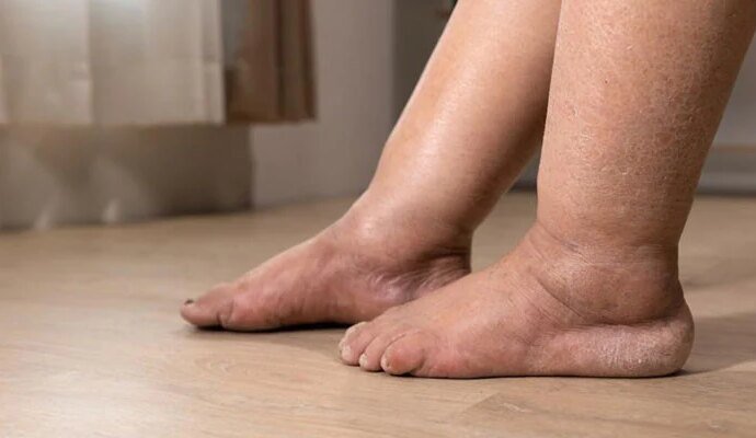 1557790 020756 updates