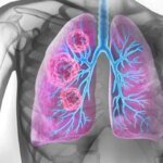 1565401 123745 updates