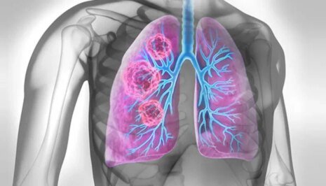 1565401 123745 updates