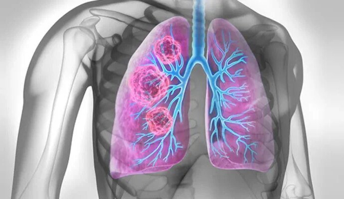 1565401 123745 updates