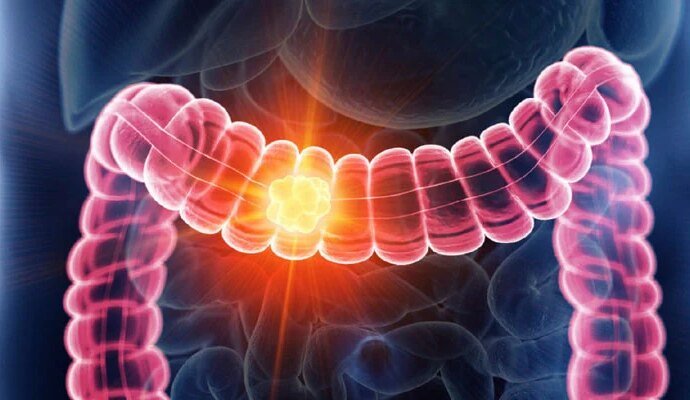 1566730 052044 updates